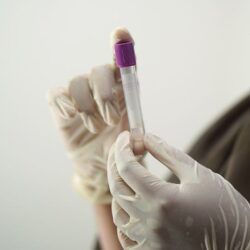 Anvisa libera a partir de hoje vários exames em farmácias; saiba quais