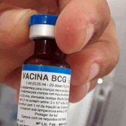 Pacientes reumáticos têm mais risco de desenvolver tuberculose