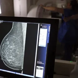 Médicos lançam guia para evitar recusa de mamografia digital